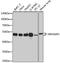 Rho GTPase Activating Protein 1 antibody, A06116-1, Boster Biological Technology, Western Blot image 