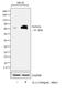 Perforin 1 antibody, MA5-12469, Invitrogen Antibodies, Western Blot image 