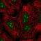 GLI Family Zinc Finger 2 antibody, NBP2-57535, Novus Biologicals, Immunofluorescence image 