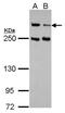 ATM Serine/Threonine Kinase antibody, MA1-23154, Invitrogen Antibodies, Western Blot image 