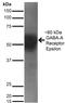 Translocating chain-associated membrane protein 1 antibody, orb137888, Biorbyt, Western Blot image 