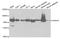 Hydroxyacyl-CoA Dehydrogenase Trifunctional Multienzyme Complex Subunit Alpha antibody, A5346, ABclonal Technology, Western Blot image 