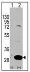 Latexin antibody, AP22768PU-N, Origene, Western Blot image 