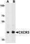 C-X-C Motif Chemokine Receptor 3 antibody, A00295, Boster Biological Technology, Western Blot image 