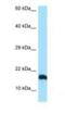 Leukocyte Specific Transcript 1 antibody, NBP1-98482, Novus Biologicals, Western Blot image 