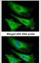 TNNI3 Interacting Kinase antibody, PA5-21989, Invitrogen Antibodies, Immunofluorescence image 