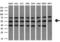 Nuclear Receptor Subfamily 1 Group H Member 3 antibody, LS-C793891, Lifespan Biosciences, Western Blot image 