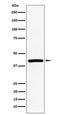 Transmembrane Protein 43 antibody, M05893, Boster Biological Technology, Western Blot image 