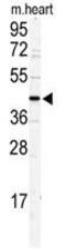 DNA Replication And Sister Chromatid Cohesion 1 antibody, GTX81965, GeneTex, Western Blot image 