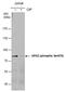 G Protein-Coupled Receptor Kinase 2 antibody, PA5-77851, Invitrogen Antibodies, Western Blot image 
