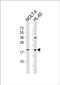 Rac Family Small GTPase 2 antibody, PA5-72241, Invitrogen Antibodies, Western Blot image 