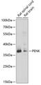 Proenkephalin-A antibody, A07495-1, Boster Biological Technology, Western Blot image 
