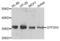 General Transcription Factor IIH Subunit 3 antibody, LS-C346269, Lifespan Biosciences, Western Blot image 