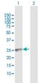 Polypeptide N-Acetylgalactosaminyltransferase 9 antibody, H00050614-D01P, Novus Biologicals, Western Blot image 