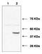 Ubiquitin Conjugating Enzyme E2 J1 antibody, GTX48665, GeneTex, Western Blot image 