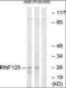 Gamma-Aminobutyric Acid Type A Receptor Epsilon Subunit antibody, orb376698, Biorbyt, Western Blot image 