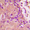 Cyclin-dependent kinase inhibitor 2A, isoforms 1/2/3 antibody, GTX32378, GeneTex, Immunohistochemistry paraffin image 