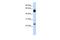 Notch Receptor 4 antibody, PA5-40479, Invitrogen Antibodies, Western Blot image 