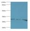 Homeobox B5 antibody, LS-C375907, Lifespan Biosciences, Western Blot image 