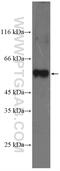 Nicotinamide Phosphoribosyltransferase antibody, 11776-1-AP, Proteintech Group, Western Blot image 