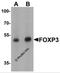 FOXP3 antibody, 7187, ProSci Inc, Western Blot image 