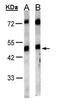 Gastrin Releasing Peptide Receptor antibody, GTX100015, GeneTex, Western Blot image 