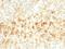 Perilipin 2 antibody, GTX02691, GeneTex, Immunohistochemistry paraffin image 