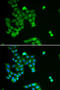 Praja Ring Finger Ubiquitin Ligase 2 antibody, STJ28527, St John