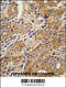 Transient Receptor Potential Cation Channel Subfamily M Member 8 antibody, 63-455, ProSci, Immunohistochemistry paraffin image 