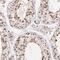 WD Repeat Domain 25 antibody, NBP1-93467, Novus Biologicals, Immunohistochemistry paraffin image 