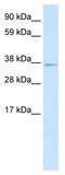 MAX Interactor 1, Dimerization Protein antibody, GTX33961, GeneTex, Western Blot image 