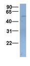 Solute Carrier Family 22 Member 11 antibody, GTX46805, GeneTex, Western Blot image 