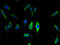 Transmembrane Protein 68 antibody, A63660-100, Epigentek, Immunofluorescence image 