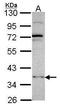 DNA Methyltransferase 3 Like antibody, GTX115985, GeneTex, Western Blot image 