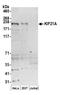 Kinesin-like protein KIF21A antibody, A304-844A, Bethyl Labs, Western Blot image 