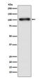 Gamma-Aminobutyric Acid Type B Receptor Subunit 1 antibody, M07297-1, Boster Biological Technology, Western Blot image 