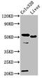 Olfactomedin 4 antibody, CSB-PA764941LA01HU, Cusabio, Western Blot image 