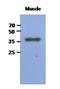 Fructose-Bisphosphatase 2 antibody, NBP2-22556, Novus Biologicals, Western Blot image 
