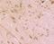 Cytochrome P450 Oxidoreductase antibody, NBP2-75626, Novus Biologicals, Immunohistochemistry paraffin image 