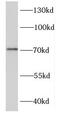 DEAD box protein HAGE antibody, FNab02309, FineTest, Western Blot image 