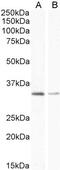 E3 ubiquitin-protein ligase Mdm2 antibody, 45-878, ProSci, Western Blot image 