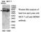 MDM4 Regulator Of P53 antibody, MBS416650, MyBioSource, Western Blot image 