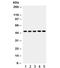 Y-Box Binding Protein 1 antibody, R32164, NSJ Bioreagents, Western Blot image 