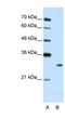 Muscleblind Like Splicing Regulator 1 antibody, NBP1-80489, Novus Biologicals, Western Blot image 