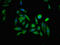 Inositol 1,4,5-Trisphosphate Receptor Type 1 antibody, LS-C673344, Lifespan Biosciences, Immunofluorescence image 