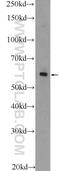 Zinc Finger Protein 419 antibody, 25724-1-AP, Proteintech Group, Western Blot image 