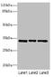 Peroxisomal Trans-2-Enoyl-CoA Reductase antibody, LS-C676246, Lifespan Biosciences, Western Blot image 