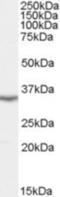 LIM And SH3 Protein 1 antibody, NB100-854, Novus Biologicals, Western Blot image 