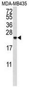 Interleukin 10 antibody, AP52181PU-N, Origene, Western Blot image 