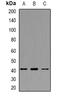 Angiotensin II type-1 receptor antibody, orb382444, Biorbyt, Western Blot image 